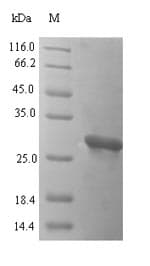 Common carp PVALB / Parvalbumin Protein (Recombinant 6His-SUMO, N-terminus)