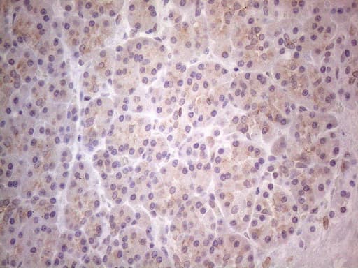 TLK2 Antibody (aa1-296, clone OTI2D10)