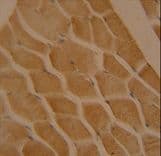 Polyclonal Rabbit anti-Human LMOD2 Antibody (aa60-88, IHC, WB)