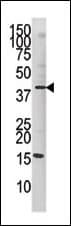 JUN / c-Jun Antibody (phospho-Ser63)
