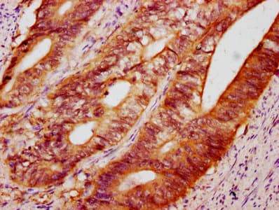 C10orf10 Antibody