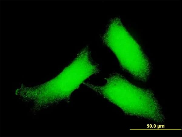 Monoclonal Mouse anti-Human CAMK2D / CaMKII Delta Antibody (clone 2E1, IF, WB)