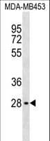 MLST8 / GBL Antibody (aa284-313)