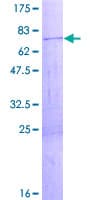Human ZCCHC3 Protein (Recombinant GST)