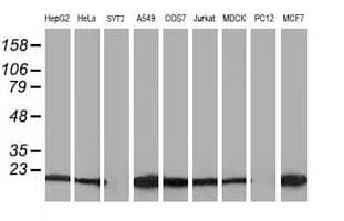 DSTN / Destrin Antibody (clone OTI2F7)