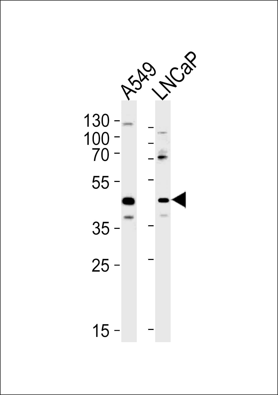 Gametogenetin / GGN Antibody (aa139-163)
