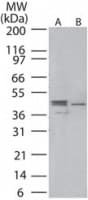 Polyclonal Rabbit anti-Human MAP2K1 / MKK1 / MEK1 Antibody (phospho-Ser218, WB)