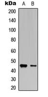 VASP Antibody (phospho-Ser238)