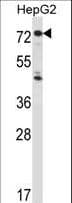 Polyclonal Rabbit anti-Human IL1R1 Antibody (aa422-450, WB)