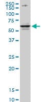 CSAD / CSD Antibody (clone 2C11)