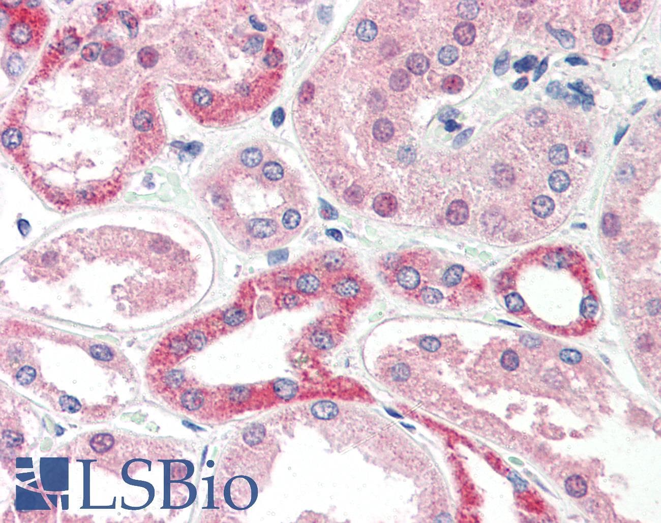 IHC-plus™ IGSF4C / CADM4 Antibody (Internal)
