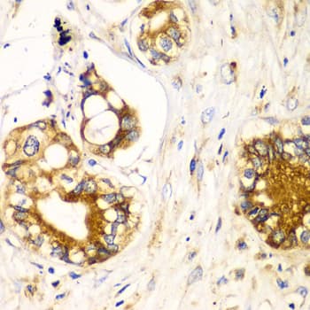 RPN1 / Ribophorin I Antibody