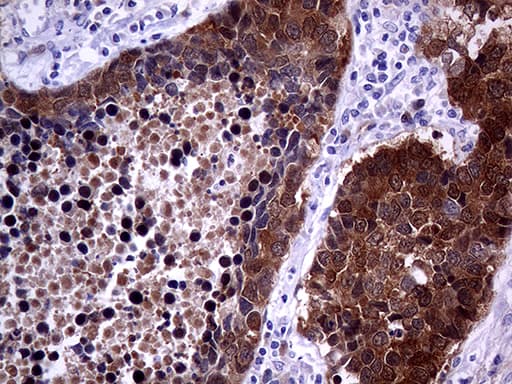 p16INK4a / CDKN2A Antibody (clone OTI11D3)