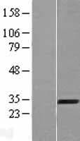 AMMECR1 Protein (Over-Expression Lysate Myc-DDK (Flag))