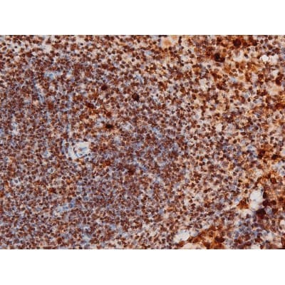 MAPK8 / JNK1 Antibody (phospho-Thr183,pTyr185)