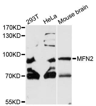 Mitofusin 2 / MFN2 Antibody
