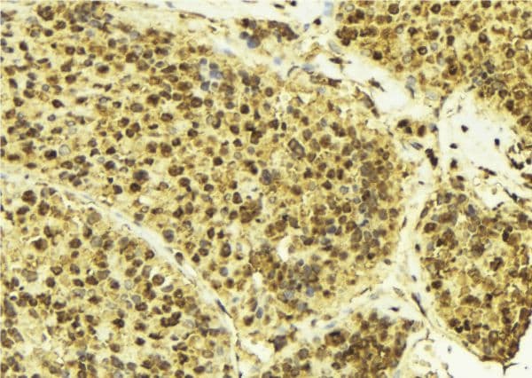 CUL3 / Cullin 3 Antibody