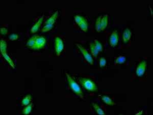 ABI2B / ABI2 Antibody