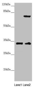 Polyclonal Rabbit anti-Human CENPK Antibody (IHC, WB)