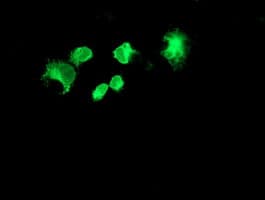 FOLH1 / PSMA Antibody (clone OTI2E1)