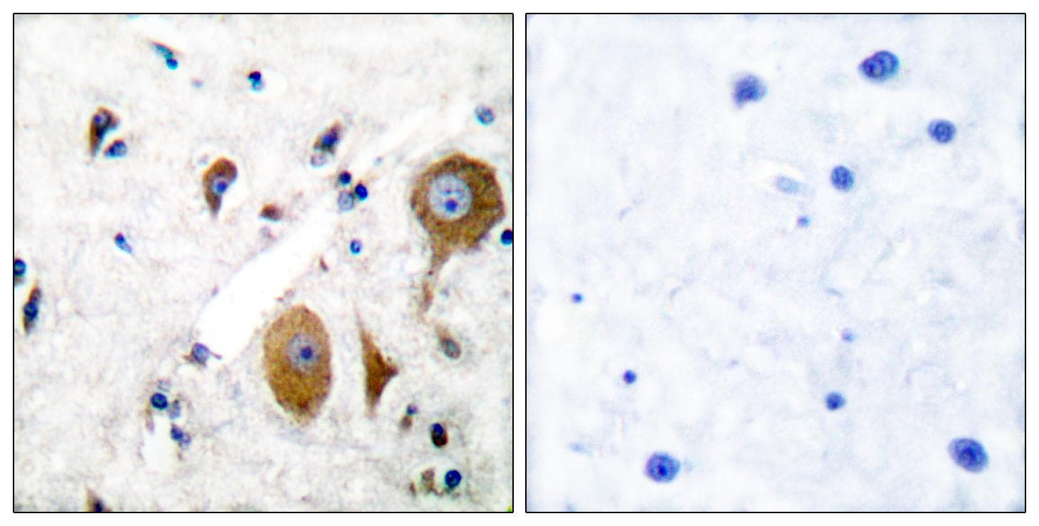 GRM8 / MGLUR8 Antibody
