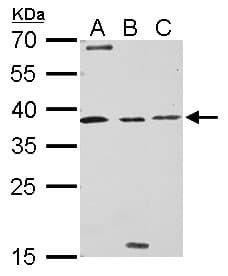 BIRC7 / Livin Antibody (aa1-241)