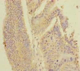 PDE6A / PDE6 Alpha Antibody