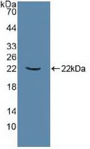 ATP1A1 Antibody (aa493-660, PE)