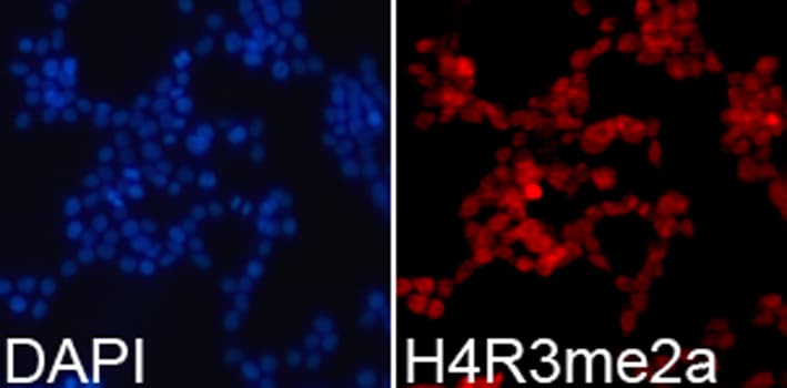 Polyclonal Rabbit anti-Human Histone H4 Antibody (Asym-Di-Methyl-Arg3, IHC, IF, WB)