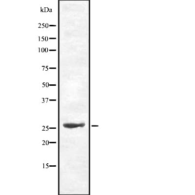 Polyclonal Rabbit anti-Human CDC34 Antibody (WB)