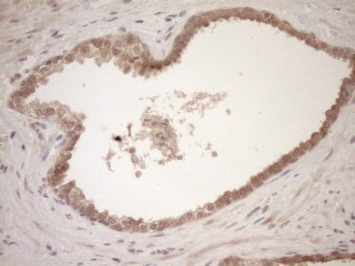 Monoclonal Mouse anti-Human TCP10 Antibody (clone OTI2C2, IHC, WB)