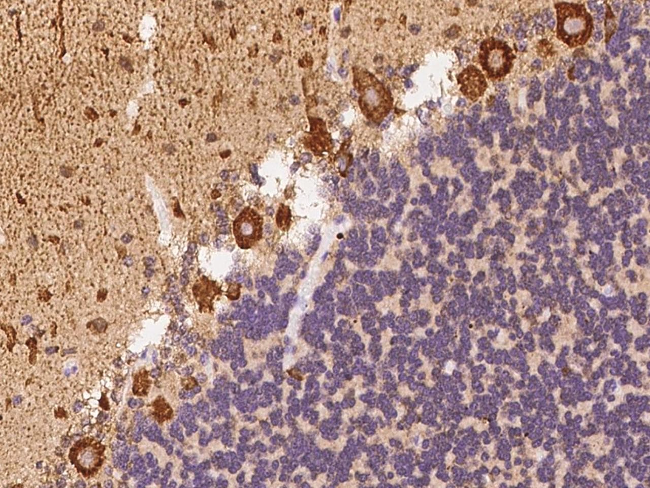 CHD5 Antibody