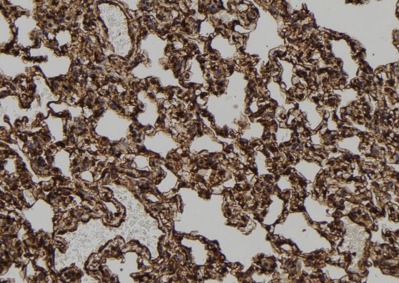 Apoptosis related protein (APR-2) Antibody