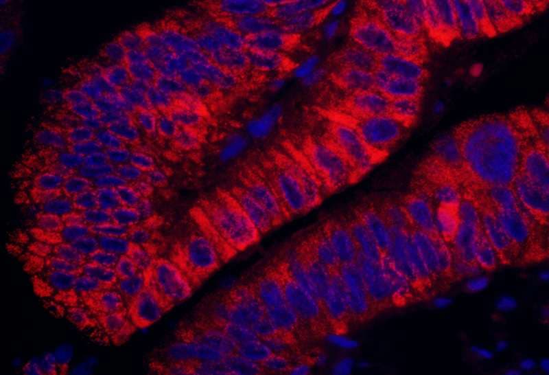 ARHGEF5 Antibody (aa600-650)