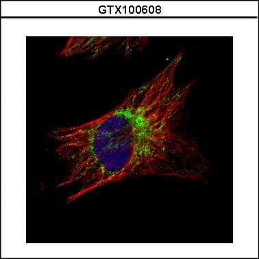 Polyclonal Rabbit anti-Human DNAJA3 / TID1 Antibody (IHC, IF, WB)
