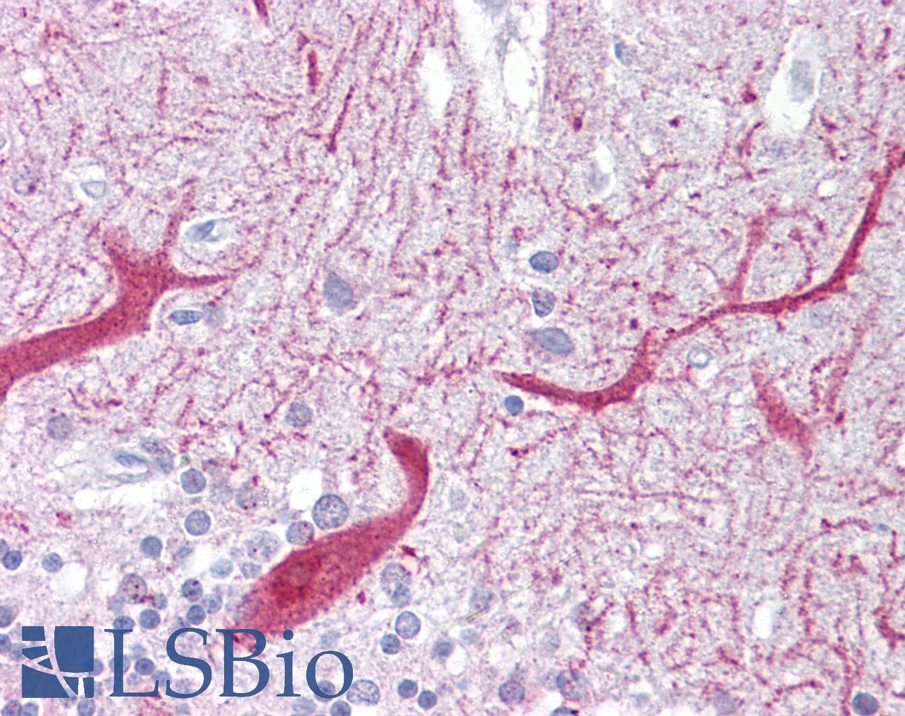 PON1 / ESA Antibody (aa215-264)