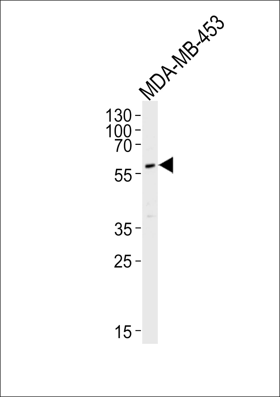 PIK3R3 / p85 Gamma Antibody (aa316-346)