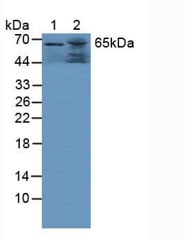 GAA / Alpha-Glucosidase, Acid Antibody (aa595-770)