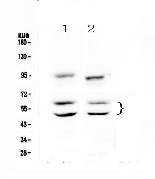 Polyclonal Rabbit anti-Human CAMK2A / CaMKII Alpha Antibody (WB)