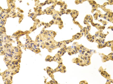 PPP4C Antibody