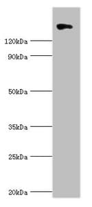 Polyclonal Rabbit anti-Human COL2A1 / Collagen II Alpha 1 Antibody (IHC, WB)