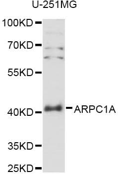 Polyclonal Rabbit anti-Human ARPC1A Antibody (WB)