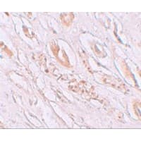TMEM59 Antibody
