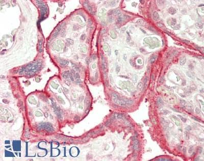 IHC-plus™ CD59 Antibody (aa26-102)