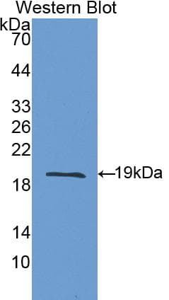 IL1RN Antibody (aa26-177)