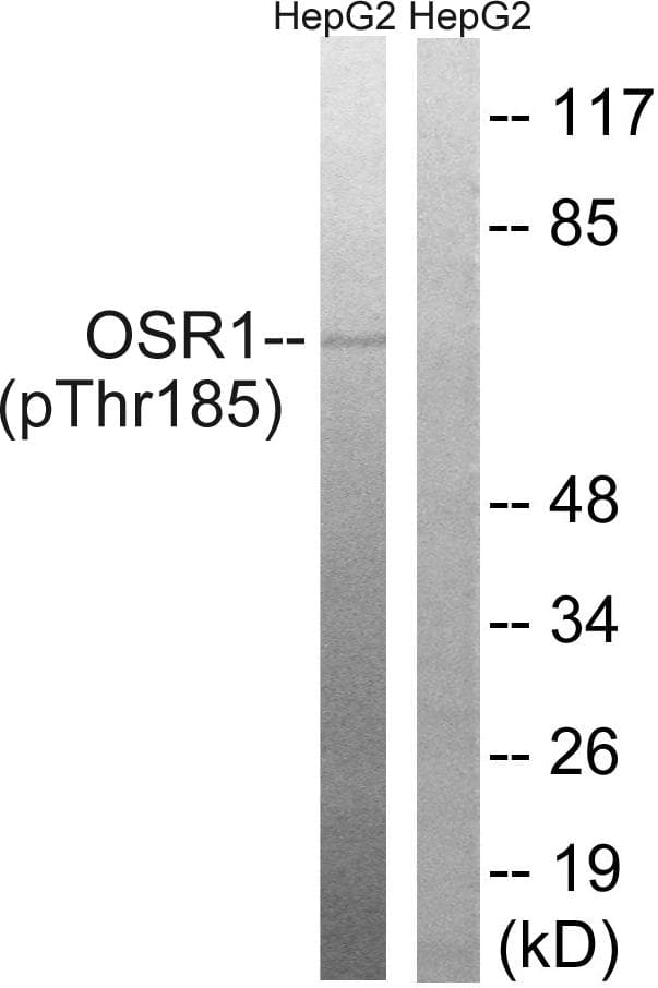 OXSR1 / OSR1 Antibody (phospho-Thr185)