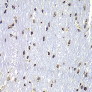 LYN Antibody