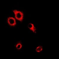 SARS / Serine-tRNA Ligase Antibody