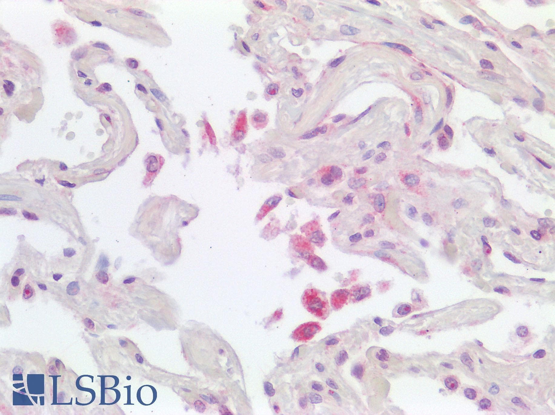 F3 / CD142 / Tissue factor Antibody