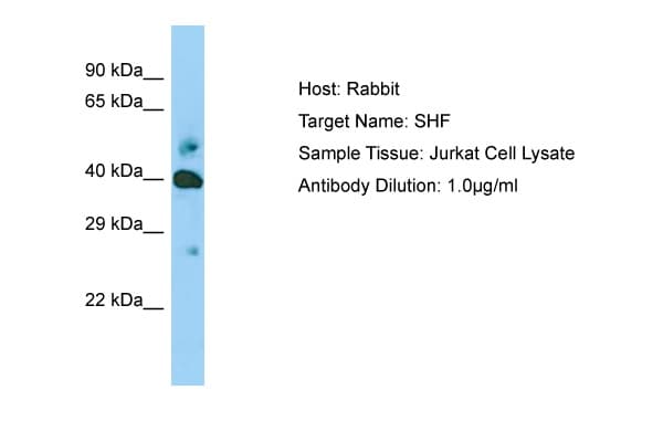 SHF Antibody (aa22-71)